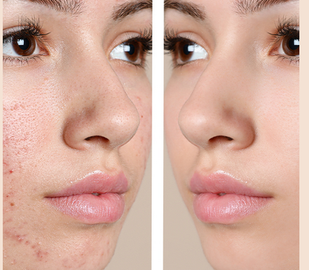 Skincare Solutions Await with Cypress’s Dermatologists post thumbnail image